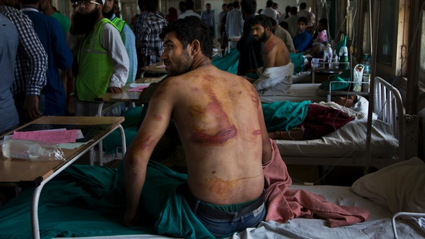 Youths mercilessly thrashed by the Indian army and the police being treated in a Srinagar hospital. One of then, Shabir Ahmed Mangoo of Khrew of Pulwama district of South Kashmir died of the beaten he got. 