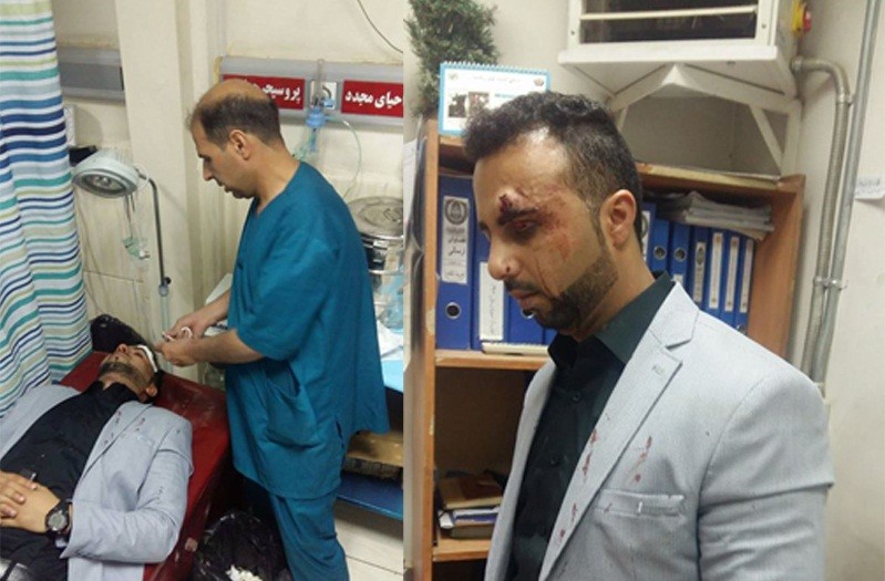 aFghanistan Times editor in chief, Abdul Saboor Sarir with a gash on his head inflicted by a rifle butt