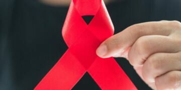 Increase in HIV cases among youths aged 15 - 24 years, doctors say