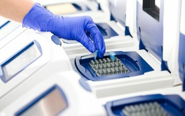 Post-mortem PCR not mandatory for all deaths