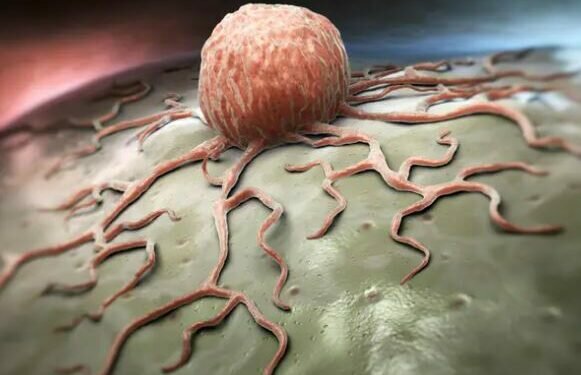 Close-up view of a cancer cell. Credit: Alexey Kotelnikov / Alamy Stock Photo