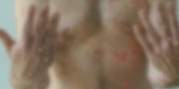 Sri Lanka detects its first monkeypox case