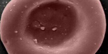 A laboratory-grown red blood cell, which carriers oxygen and carbon dioxide around the body Image credits - NHSBT