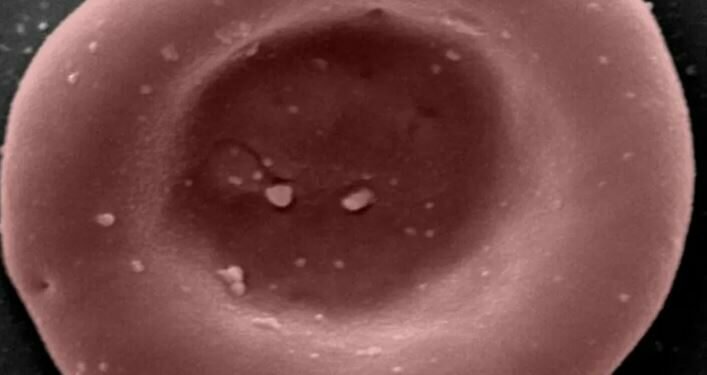 A laboratory-grown red blood cell, which carriers oxygen and carbon dioxide around the body Image credits - NHSBT